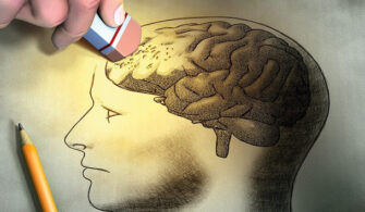 alzheimer